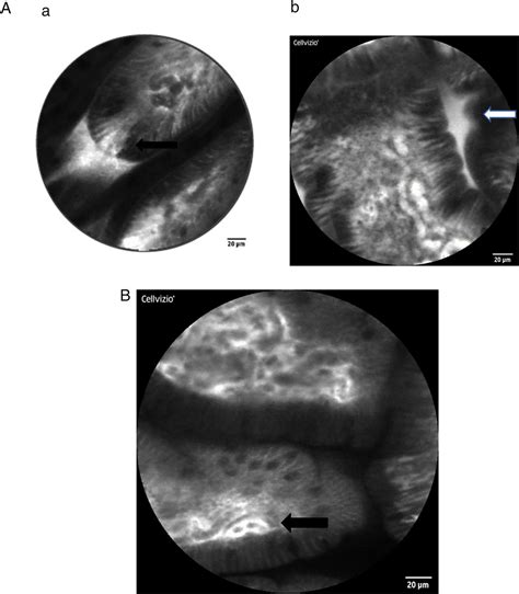 Visualising and quantifying intestinal permeability 